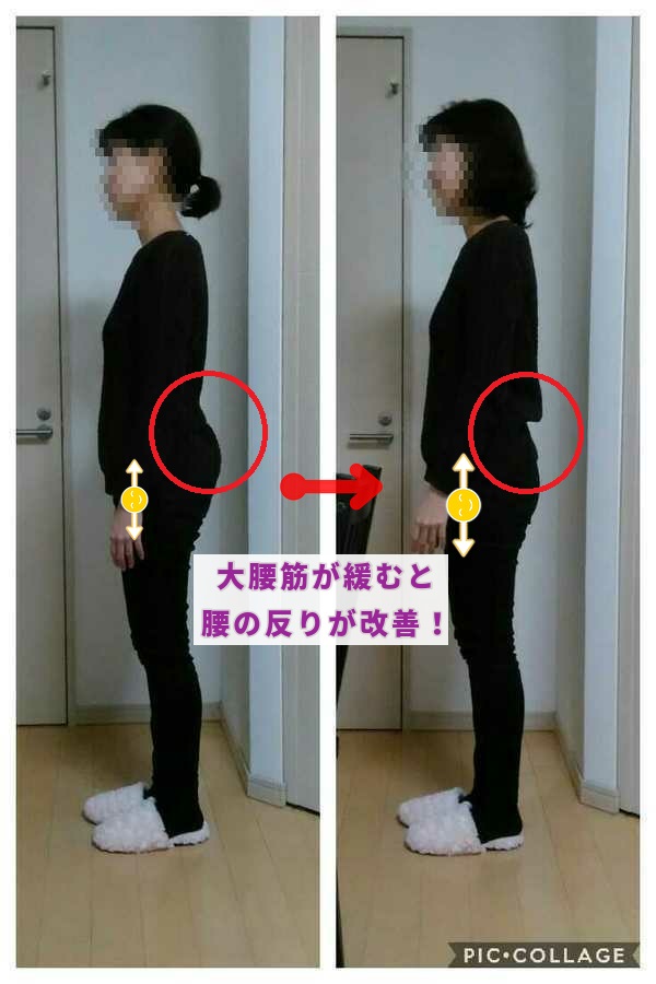 大阪 奈良で腰痛のテーピング方法 セルフケアを学ぶ ベクトルテーピング腰痛講座